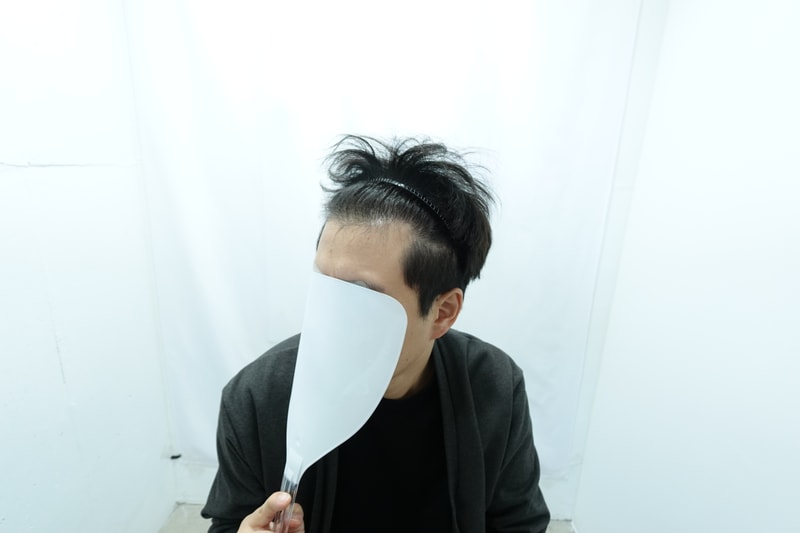 [JARADA CLINIC] 365 days review since Hair Transplant.