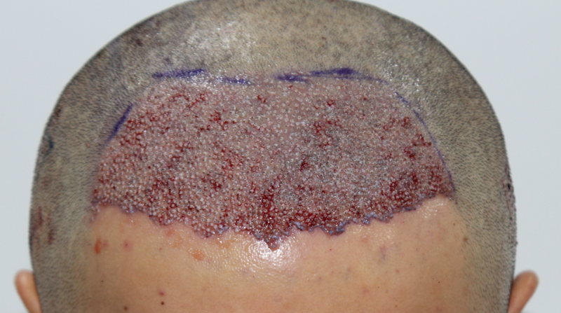 포토후기 이미지