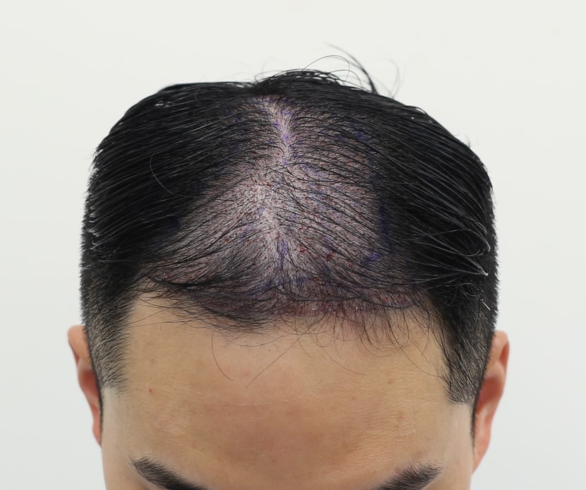 0bc6c71d9549cd5923f260a7a9e2791f_1763887691_3198.jpg 0bc6c71d9549cd5923f260a7a9e2791f_1763887691_3198.jpg