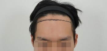 1ac107479b4242bebd47740e06774c9d_1763363915_8673.jpg 1ac107479b4242bebd47740e06774c9d_1763363915_8673.jpg