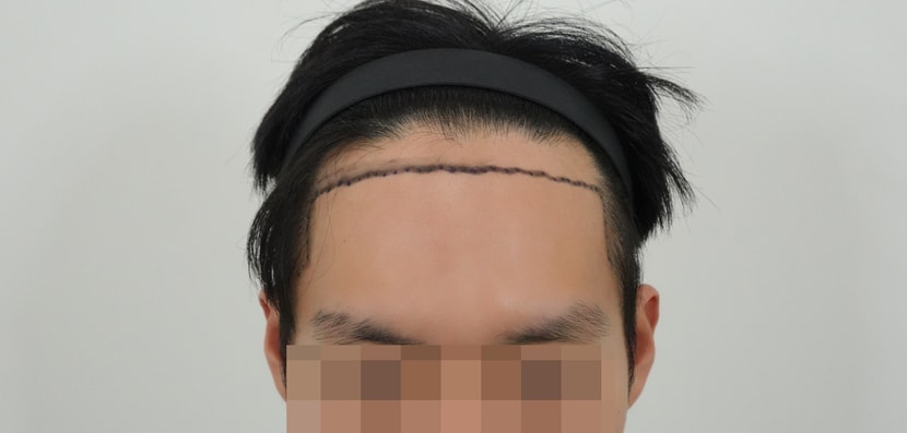 1ac107479b4242bebd47740e06774c9d_1763363915_8673.jpg 1ac107479b4242bebd47740e06774c9d_1763363915_8673.jpg