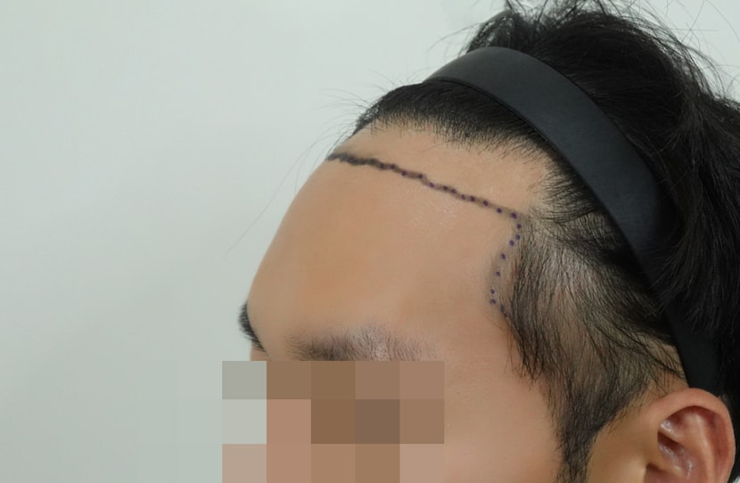 1ac107479b4242bebd47740e06774c9d_1763363915_9775.jpg 1ac107479b4242bebd47740e06774c9d_1763363915_9775.jpg