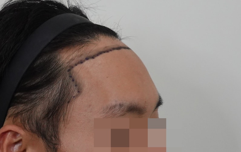 1ac107479b4242bebd47740e06774c9d_1763363916_0857.jpg 1ac107479b4242bebd47740e06774c9d_1763363916_0857.jpg