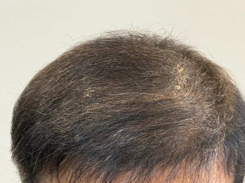 28c7e7c10168ce18a2345de6e3a02d11_1764167530_5653.jpg 28c7e7c10168ce18a2345de6e3a02d11_1764167530_5653.jpg