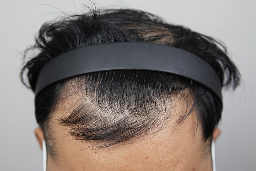 38ba8650e0ba080ad409118c7adf53ff_1764057862_2489.jpg 38ba8650e0ba080ad409118c7adf53ff_1764057862_2489.jpg