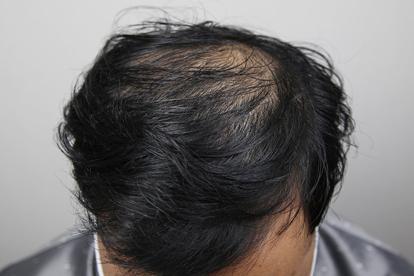 38ba8650e0ba080ad409118c7adf53ff_1764057862_3132.jpg 38ba8650e0ba080ad409118c7adf53ff_1764057862_3132.jpg