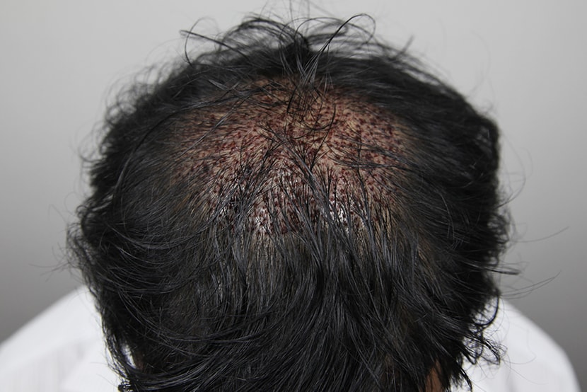 38ba8650e0ba080ad409118c7adf53ff_1764057862_4454.jpg 38ba8650e0ba080ad409118c7adf53ff_1764057862_4454.jpg