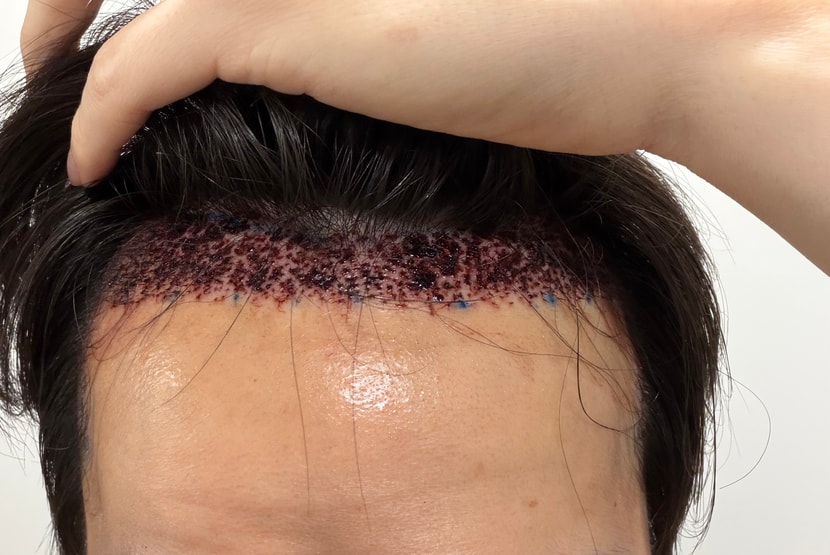 38d2ab956d818d82a28688017ace9450_1764218590_6546.jpg 38d2ab956d818d82a28688017ace9450_1764218590_6546.jpg