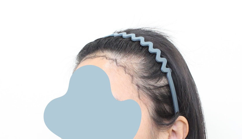 3aa5426bbe794068694b2c345bcaf6ab_1764049586_1735.jpg 3aa5426bbe794068694b2c345bcaf6ab_1764049586_1735.jpg