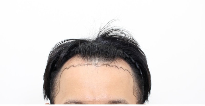 포토후기 이미지