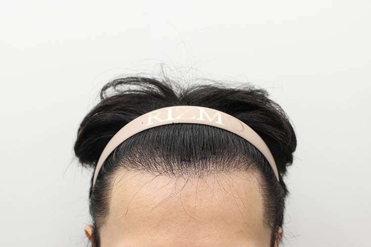 포토후기 이미지