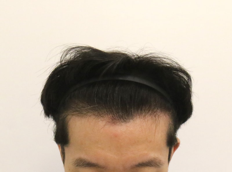 포토후기 이미지