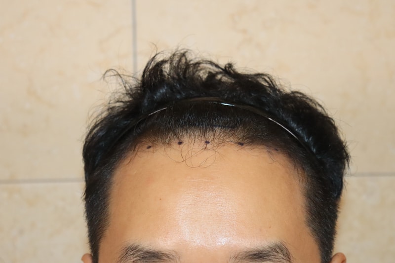 포토후기 이미지