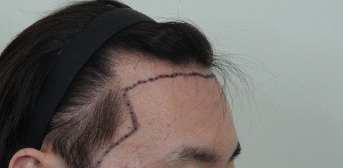 a6198048ed1a0a4b91c170e1e38b4d9a_1763363860_3148.jpg a6198048ed1a0a4b91c170e1e38b4d9a_1763363860_3148.jpg