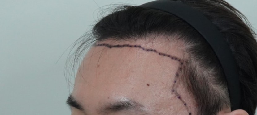 a6198048ed1a0a4b91c170e1e38b4d9a_1763363860_3714.jpg a6198048ed1a0a4b91c170e1e38b4d9a_1763363860_3714.jpg