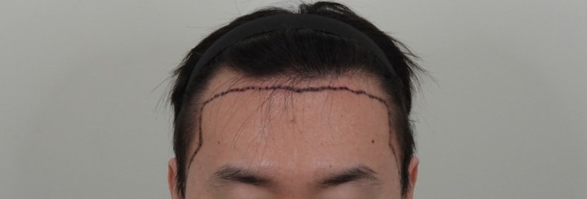 a6198048ed1a0a4b91c170e1e38b4d9a_1763363860_4261.jpg a6198048ed1a0a4b91c170e1e38b4d9a_1763363860_4261.jpg