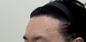 a6198048ed1a0a4b91c170e1e38b4d9a_1763363860_4927.jpg a6198048ed1a0a4b91c170e1e38b4d9a_1763363860_4927.jpg