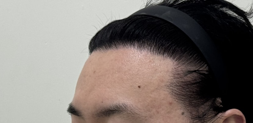 a6198048ed1a0a4b91c170e1e38b4d9a_1763363860_4927.jpg a6198048ed1a0a4b91c170e1e38b4d9a_1763363860_4927.jpg