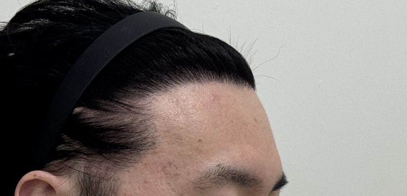 a6198048ed1a0a4b91c170e1e38b4d9a_1763363860_5734.jpg a6198048ed1a0a4b91c170e1e38b4d9a_1763363860_5734.jpg