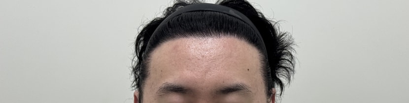 a6198048ed1a0a4b91c170e1e38b4d9a_1763363860_6655.jpg a6198048ed1a0a4b91c170e1e38b4d9a_1763363860_6655.jpg