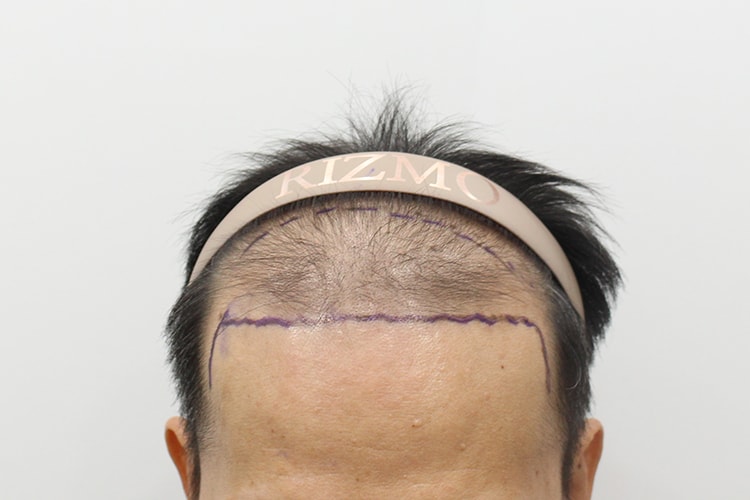 포토후기 이미지