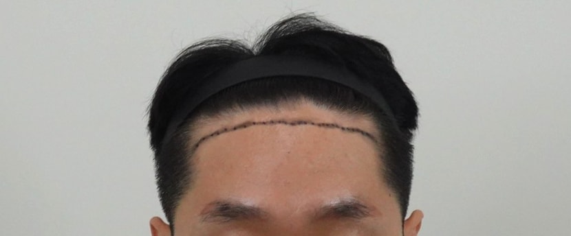 c28404344251a8d39be2b4864946bf0d_1763451435_1559.jpg c28404344251a8d39be2b4864946bf0d_1763451435_1559.jpg