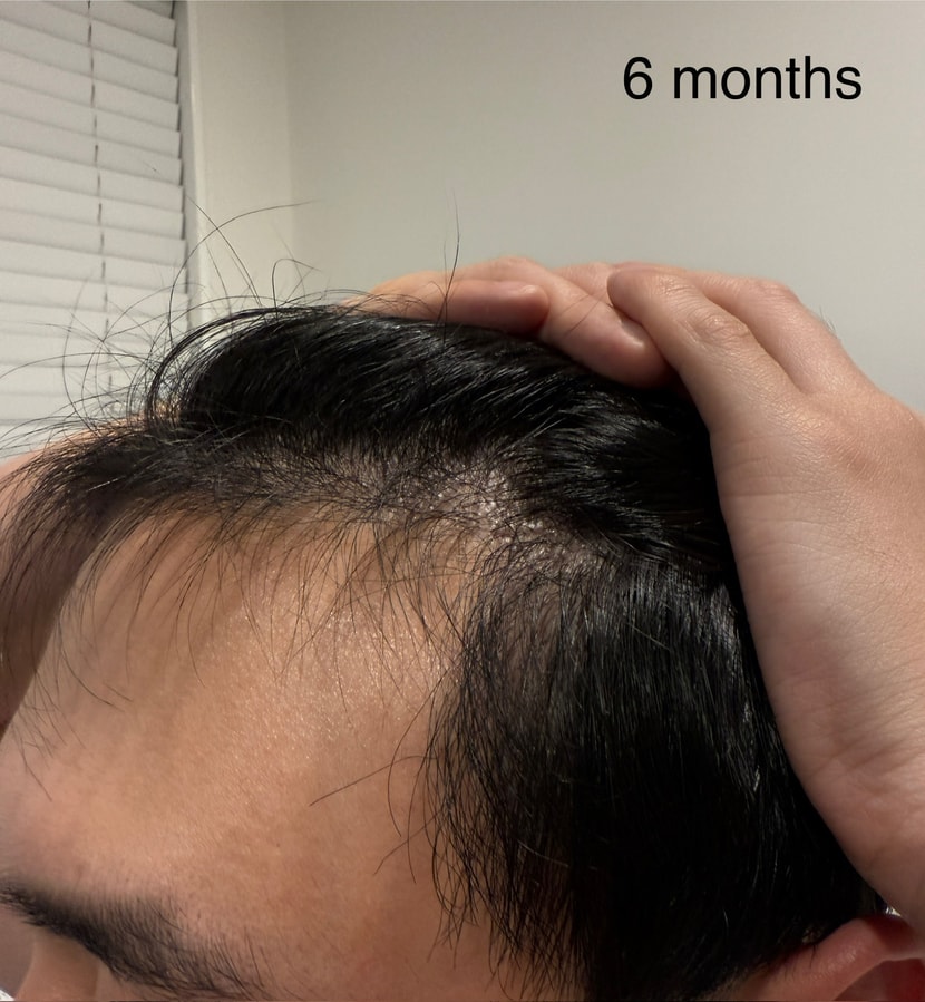 cb898328ea1ca88c8e6c8f8dfa54d14d_1762240229_071.jpeg cb898328ea1ca88c8e6c8f8dfa54d14d_1762240229_071.jpeg