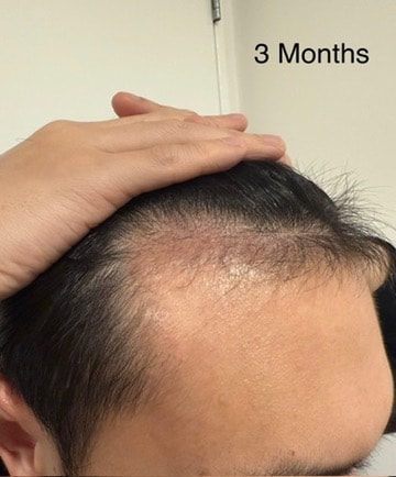 cb898328ea1ca88c8e6c8f8dfa54d14d_1762240232_9647.jpeg cb898328ea1ca88c8e6c8f8dfa54d14d_1762240232_9647.jpeg