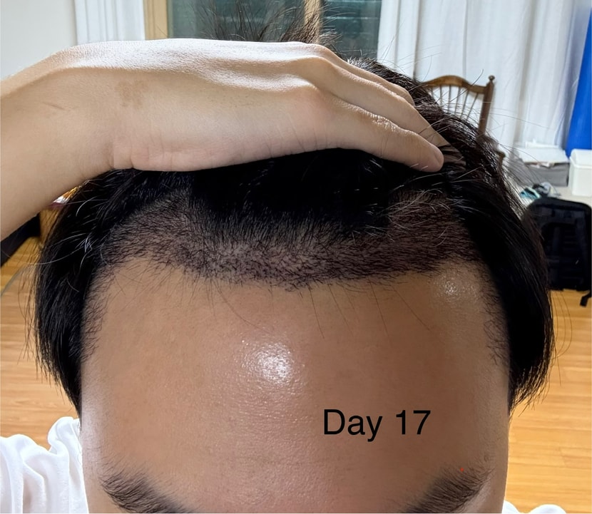 cb898328ea1ca88c8e6c8f8dfa54d14d_1762240243_9653.jpeg cb898328ea1ca88c8e6c8f8dfa54d14d_1762240243_9653.jpeg