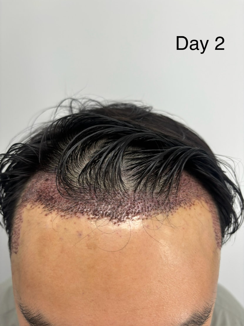 cb898328ea1ca88c8e6c8f8dfa54d14d_1762240249_6447.jpeg cb898328ea1ca88c8e6c8f8dfa54d14d_1762240249_6447.jpeg