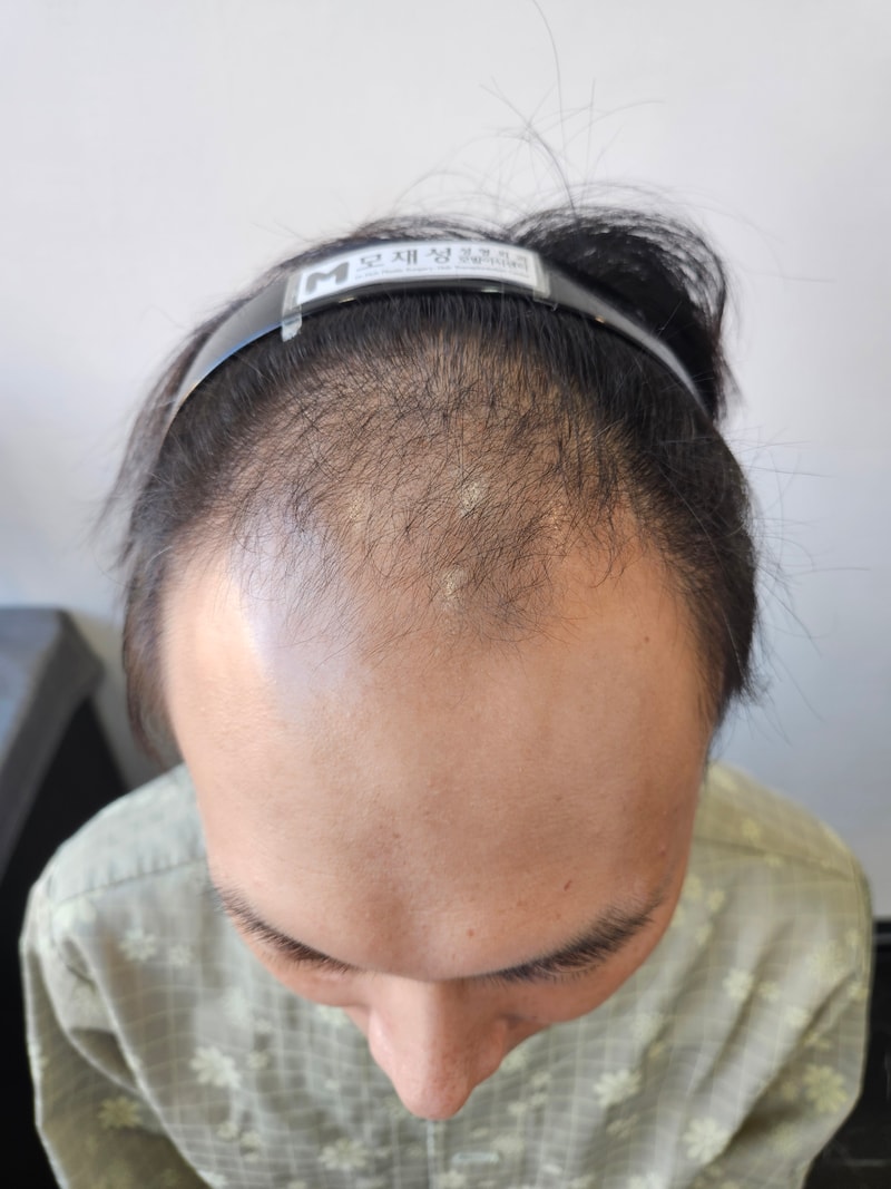 포토후기 이미지