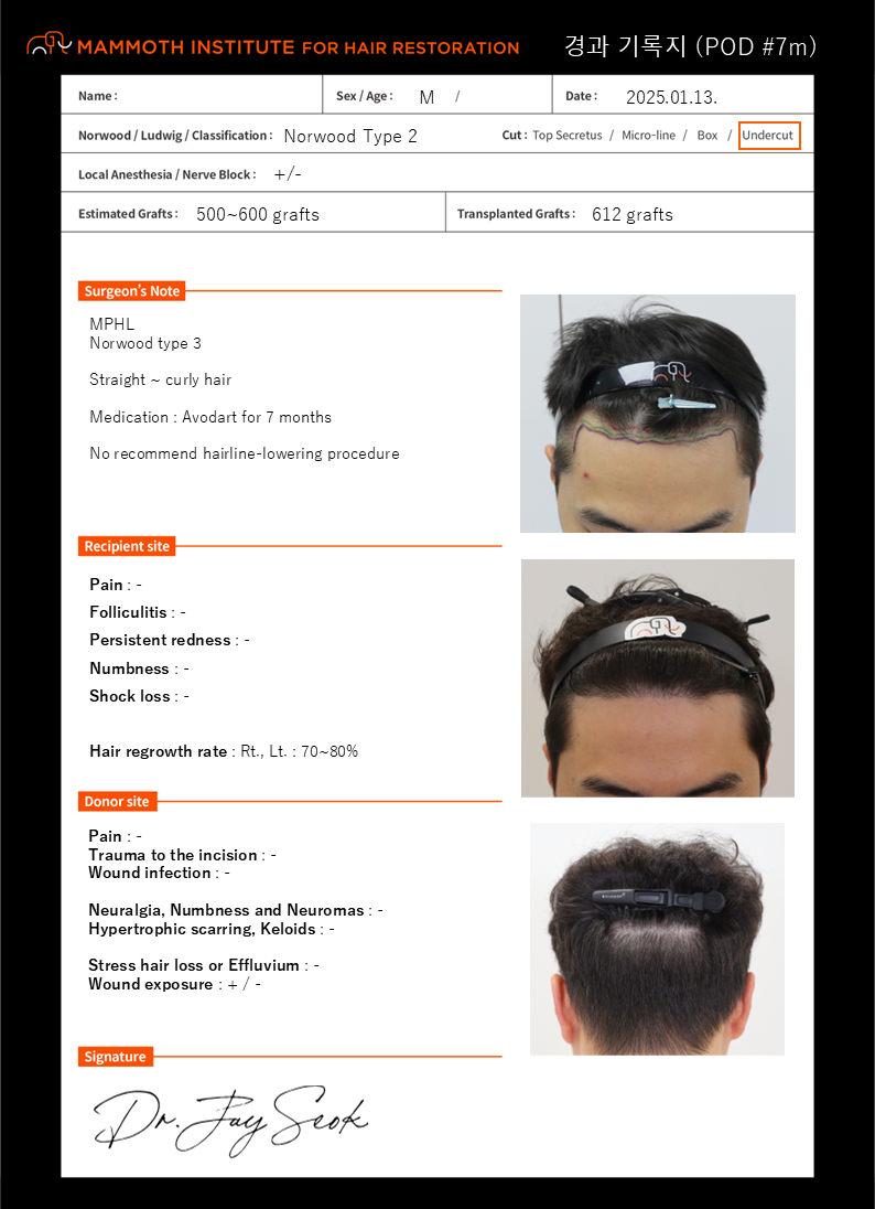 포토후기 이미지