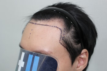 dc7689b9d2b39d967f35d0a724211759_1763265078_3193.jpg dc7689b9d2b39d967f35d0a724211759_1763265078_3193.jpg