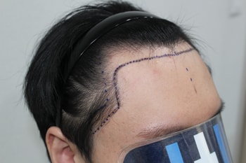 dc7689b9d2b39d967f35d0a724211759_1763265078_4641.jpg dc7689b9d2b39d967f35d0a724211759_1763265078_4641.jpg