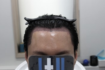 dc7689b9d2b39d967f35d0a724211759_1763265093_6052.jpg dc7689b9d2b39d967f35d0a724211759_1763265093_6052.jpg