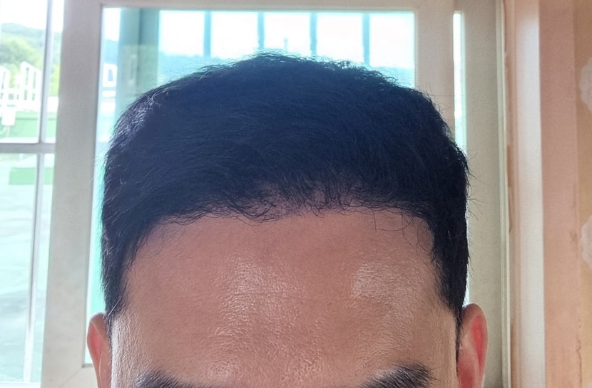 de3dc9a60b0ed2a6c4355702ad026527_1763427863_3725.jpg de3dc9a60b0ed2a6c4355702ad026527_1763427863_3725.jpg