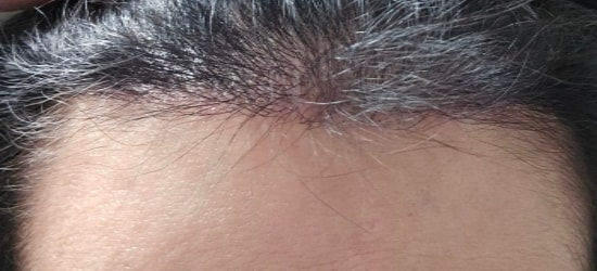 인천 마이모 6개월차 후기입니다.