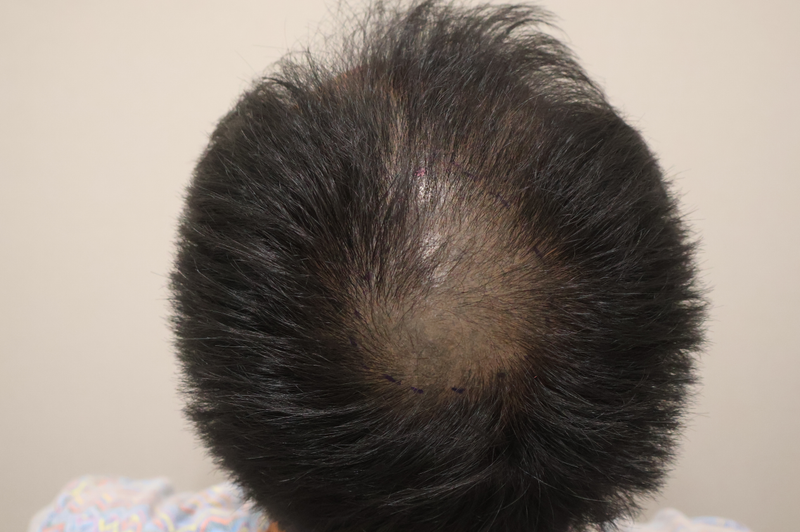 포토후기 이미지