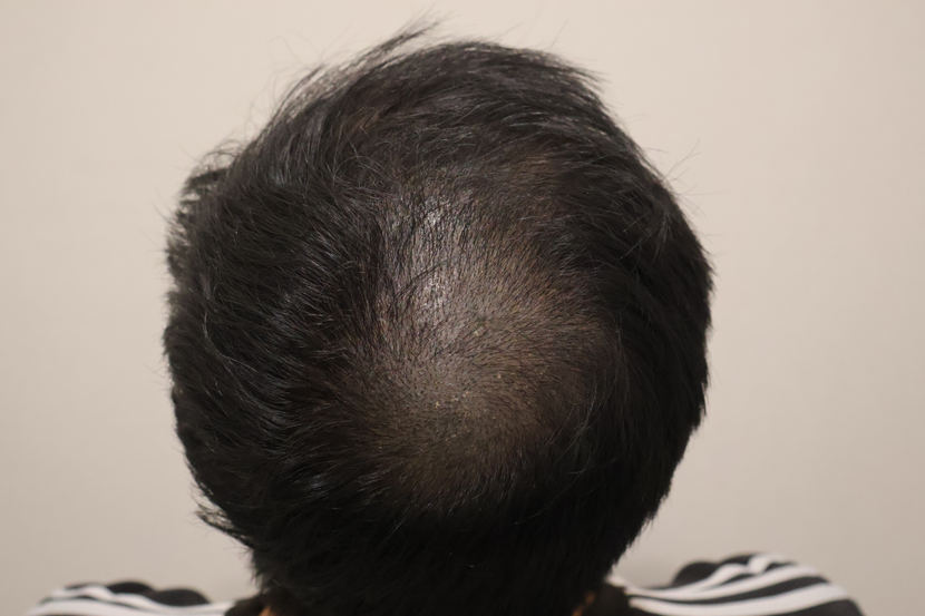 eb0f5dd81981230e2d1f08900438e801_1762218347_9782.png eb0f5dd81981230e2d1f08900438e801_1762218347_9782.png