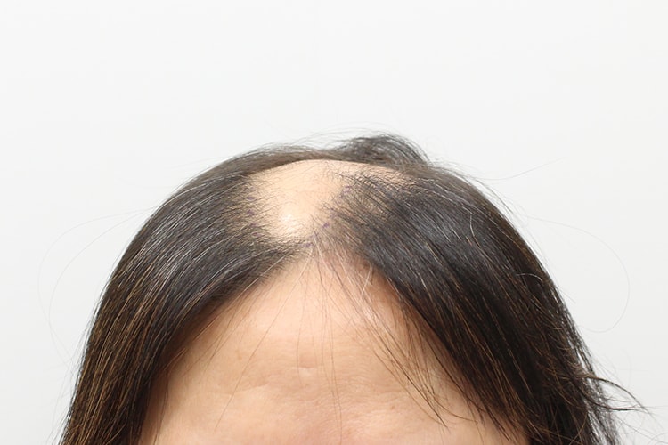 f41de892a916f17b436e09567742193a_1763108059_0727.jpg f41de892a916f17b436e09567742193a_1763108059_0727.jpg