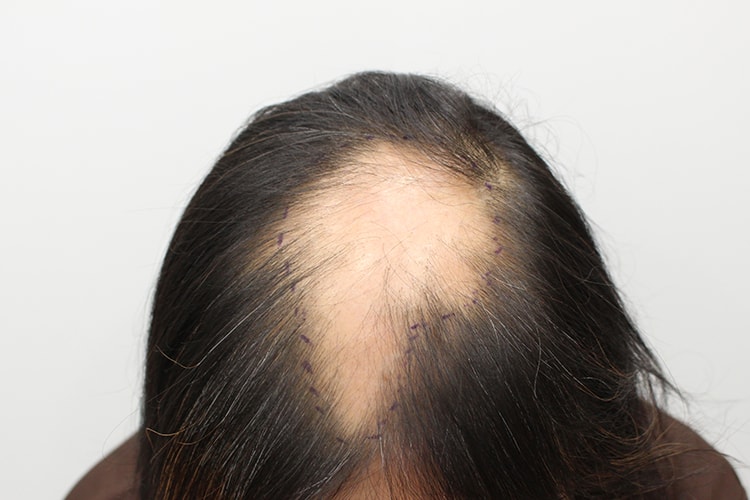 f41de892a916f17b436e09567742193a_1763108059_197.jpg f41de892a916f17b436e09567742193a_1763108059_197.jpg