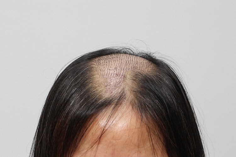 f41de892a916f17b436e09567742193a_1763108059_4334.jpg f41de892a916f17b436e09567742193a_1763108059_4334.jpg