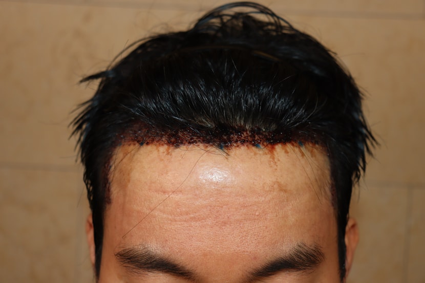 0d76777be894ddfedcfd0532e38a156a_1764662237_3537.jpg 0d76777be894ddfedcfd0532e38a156a_1764662237_3537.jpg