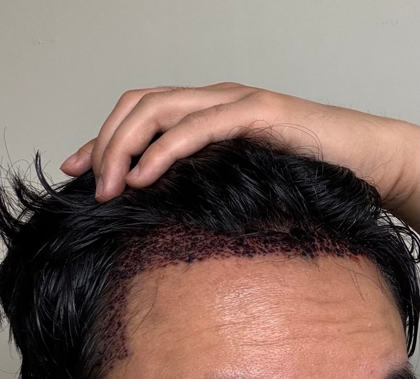 0d76777be894ddfedcfd0532e38a156a_1764662239_9203.jpeg 0d76777be894ddfedcfd0532e38a156a_1764662239_9203.jpeg