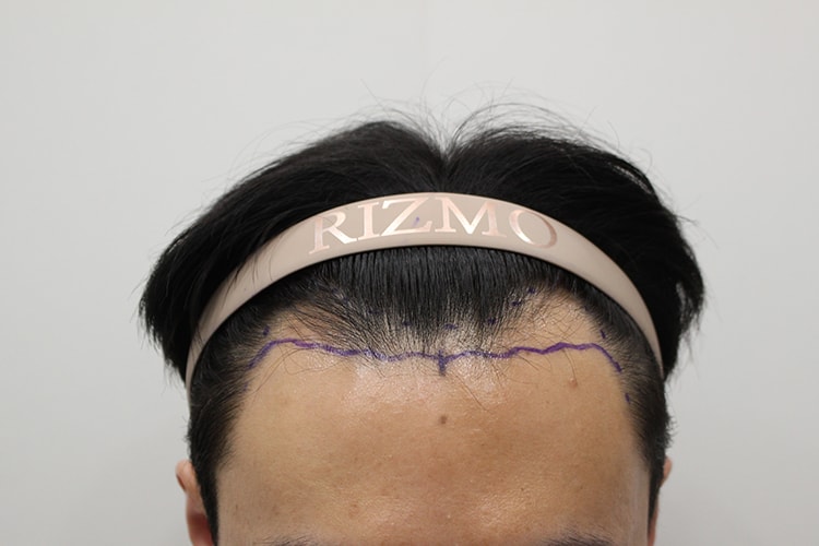 대전 리즈모 M자 2000모 후기 납깁니다.