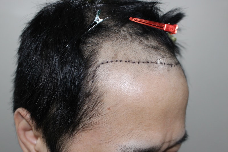 포토후기 이미지