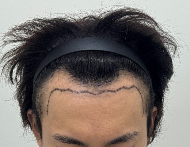 포토후기 이미지