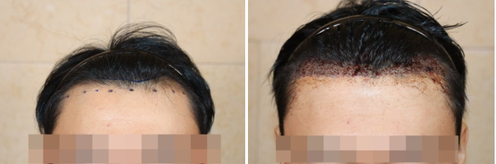 포토후기 이미지