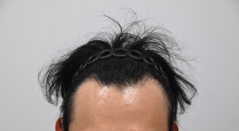 포토후기 이미지