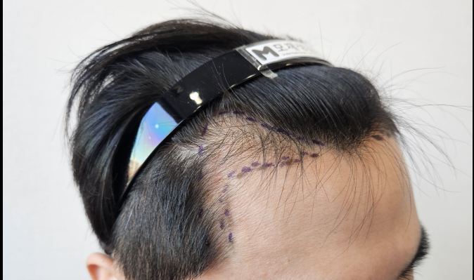 9508e2fa51ce02899693aa1e687b75f7_1764660139_2057.png 9508e2fa51ce02899693aa1e687b75f7_1764660139_2057.png